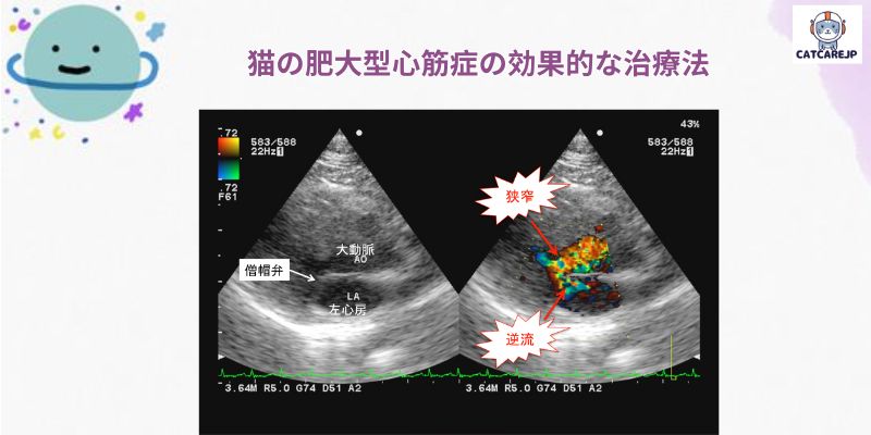 猫の肥大型心筋症の効果的な治療法