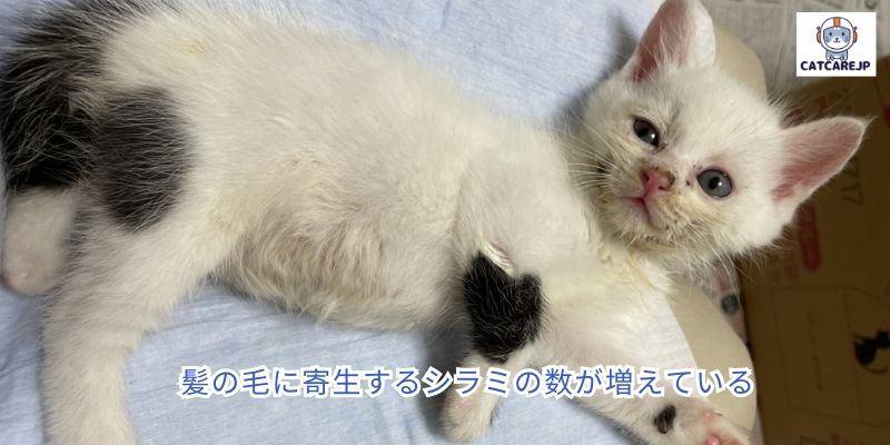 髪の毛に寄生するシラミの数が増えている